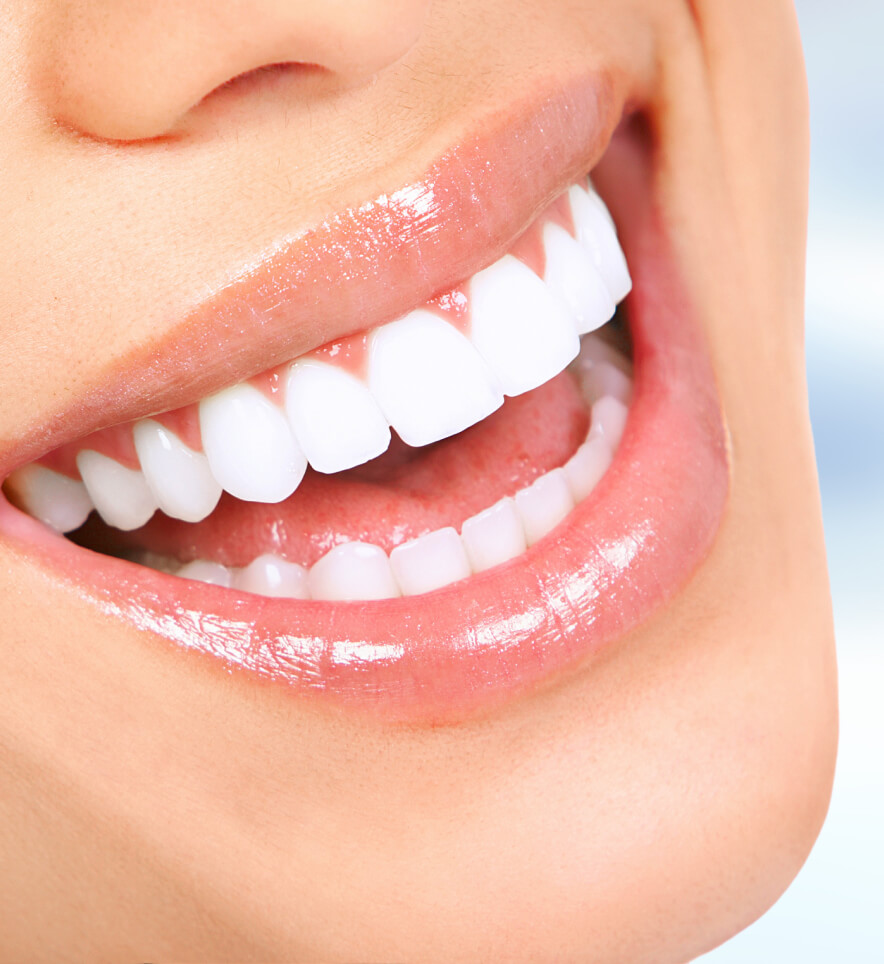 Dental Crowns | Cosmetic Dentist in Bakersfield, CA