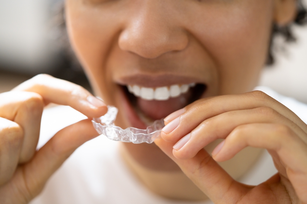 woman putting in Invisalign